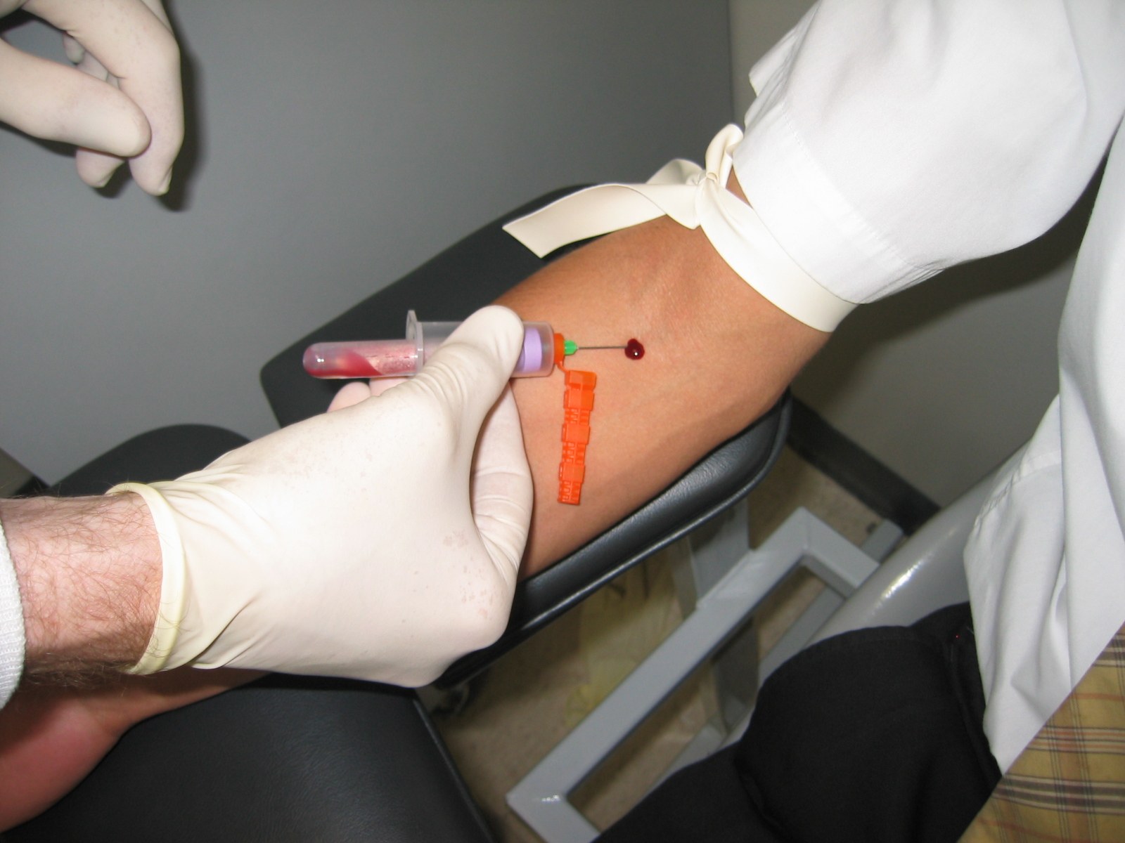 A blood sample being taken